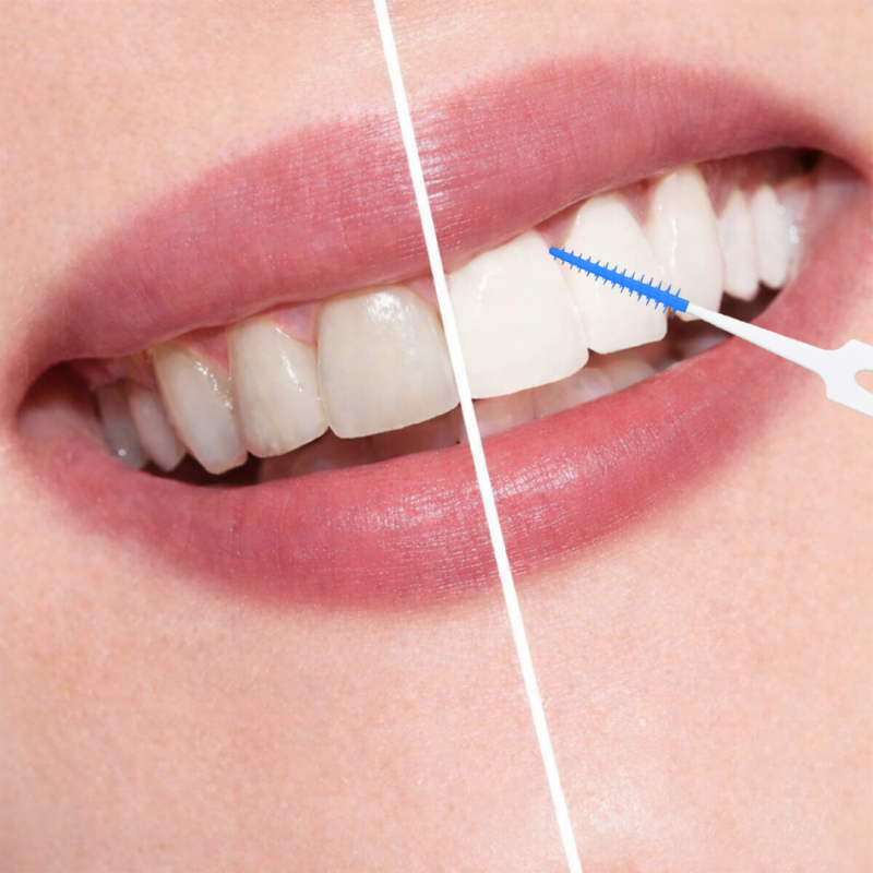 Szczoteczka / czyścik do przestrzeni międzyzębowych E1166